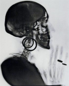 Meret Oppenheim, X-ray of my skull (1964)
